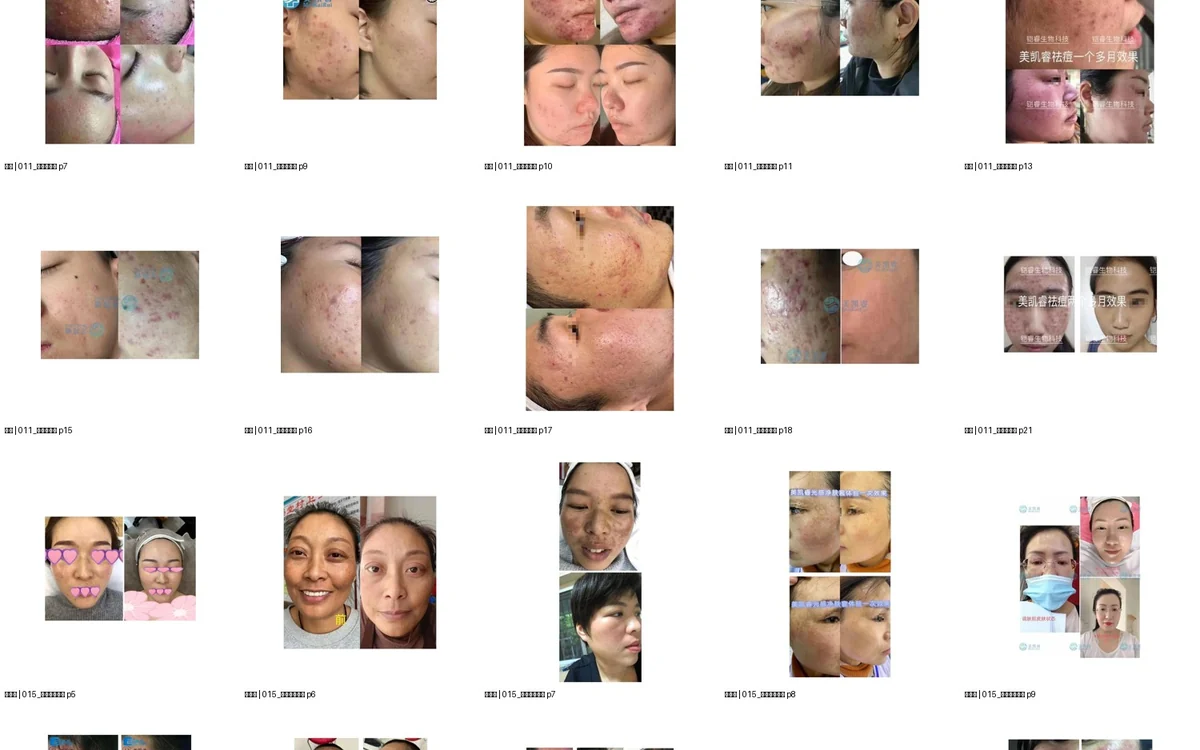 怎样理性查看网站上的真实案例